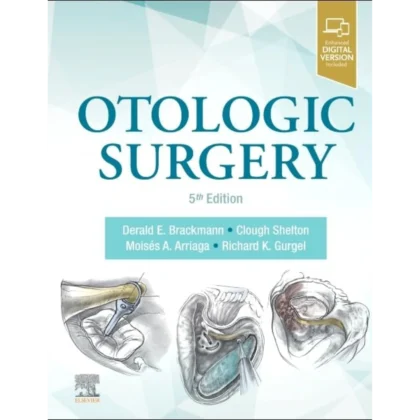 Otologic Surgery