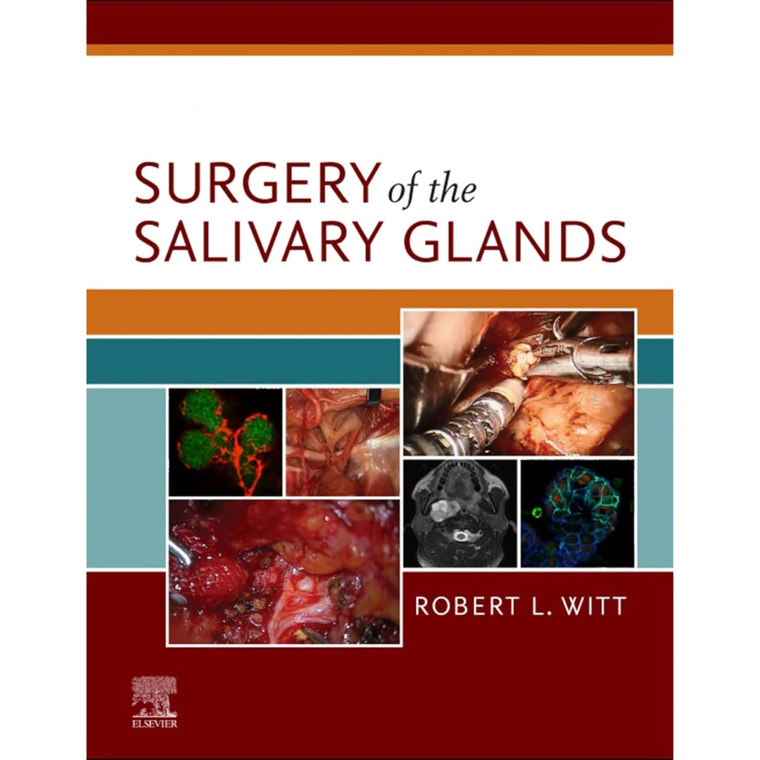 Surgery of the Salivary Glands