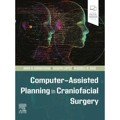 Computer-Assisted Planning in Craniofacial Surgery