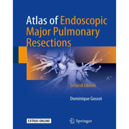 Atlas of Endoscopic Major Pulmonary Resections
