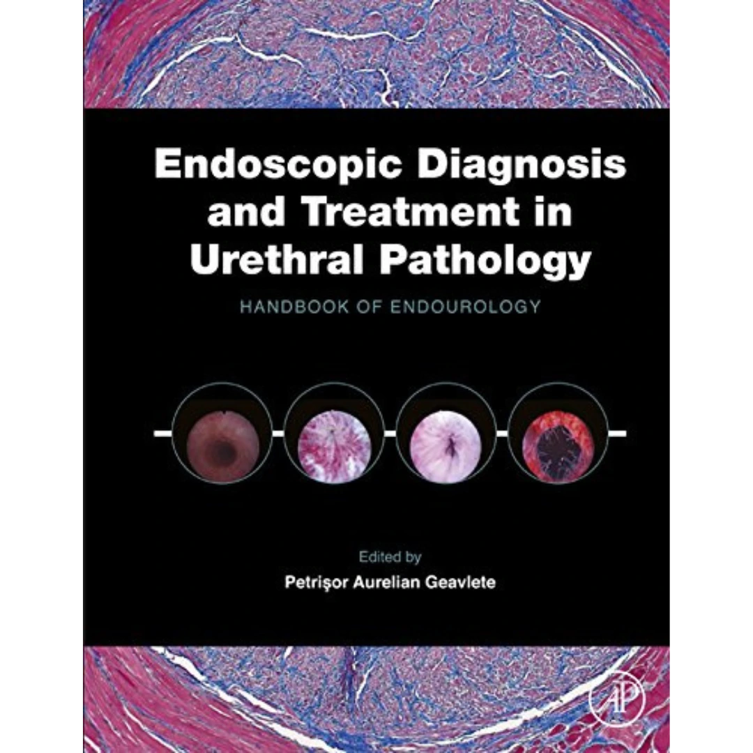 Endoscopic Diagnosis and Treatment in Urethral Pathology: Handbook of Endourology