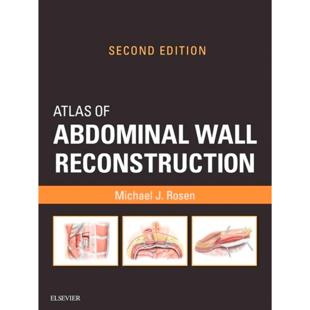 Atlas of Abdominal Wall Reconstruction: Atlas of Abdominal Wall Reconstruction