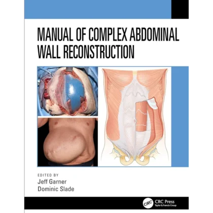 Manual of Complex Abdominal Wall Reconstruction