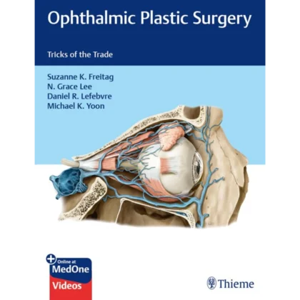 Ophthalmic Plastic Surgery: Tricks of the Trade