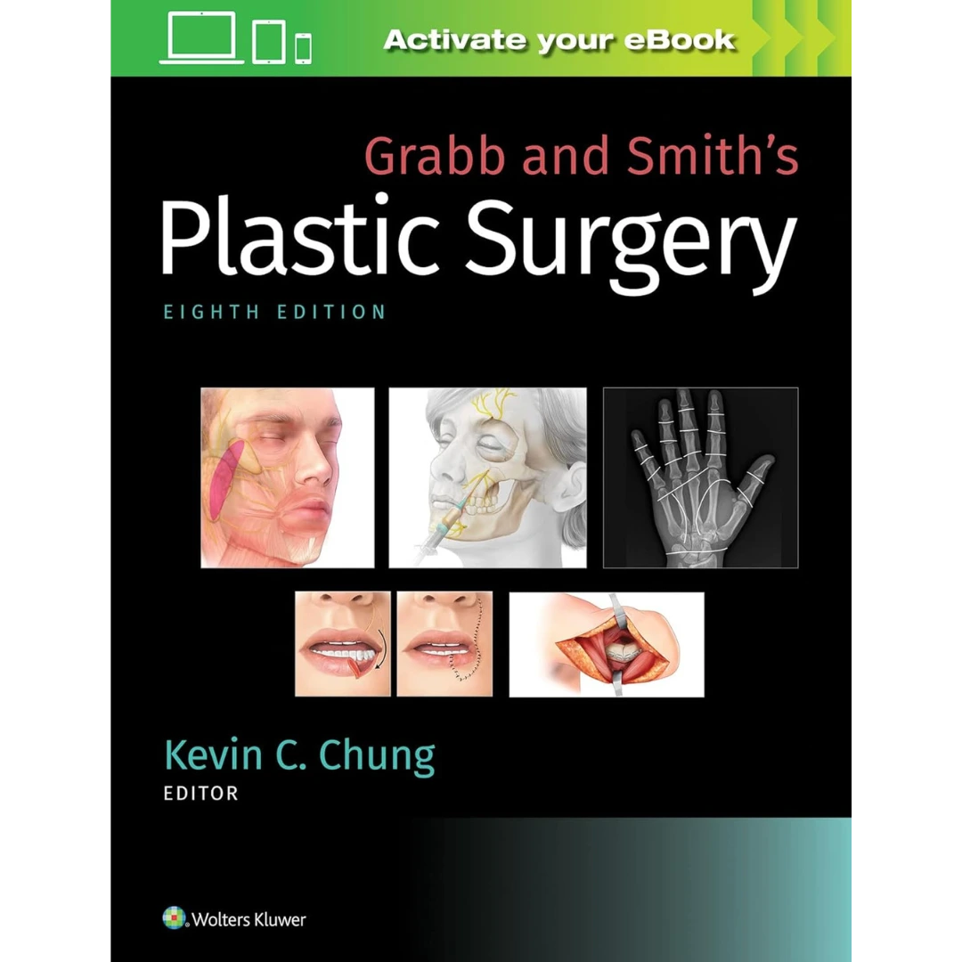 Grabb and Smith's Plastic Surgery