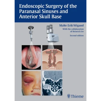 Endoscopic Surgery of the Paranasal Sinuses and Anterior Skull Base