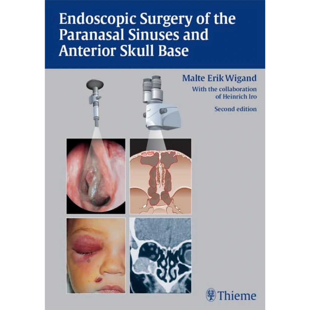 Endoscopic Surgery of the Paranasal Sinuses and Anterior Skull Base