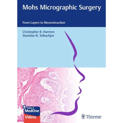 Mohs Micrographic Surgery: From Layers to Reconstruction