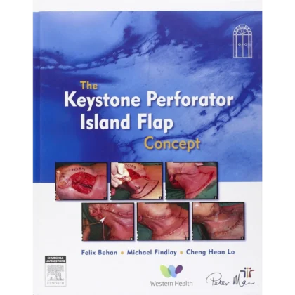 The Keystone Perforator Island Flap Concept