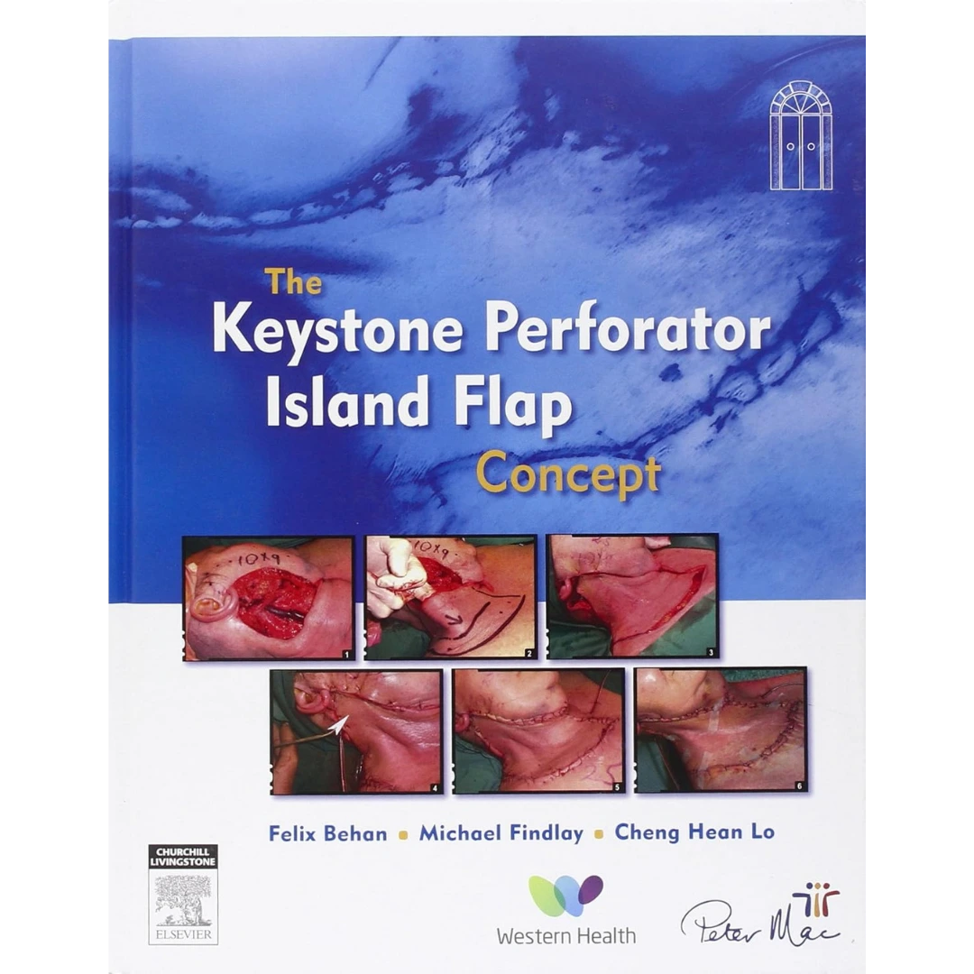 The Keystone Perforator Island Flap Concept