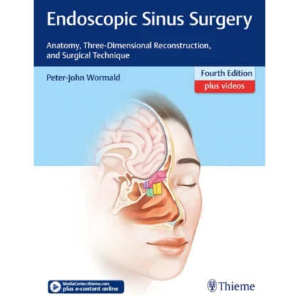 Endoscopic Sinus Surgery: Anatomy, Three-Dimensional Reconstruction, and Surgical Technique