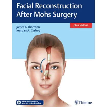 Facial Reconstruction After Mohs Surgery