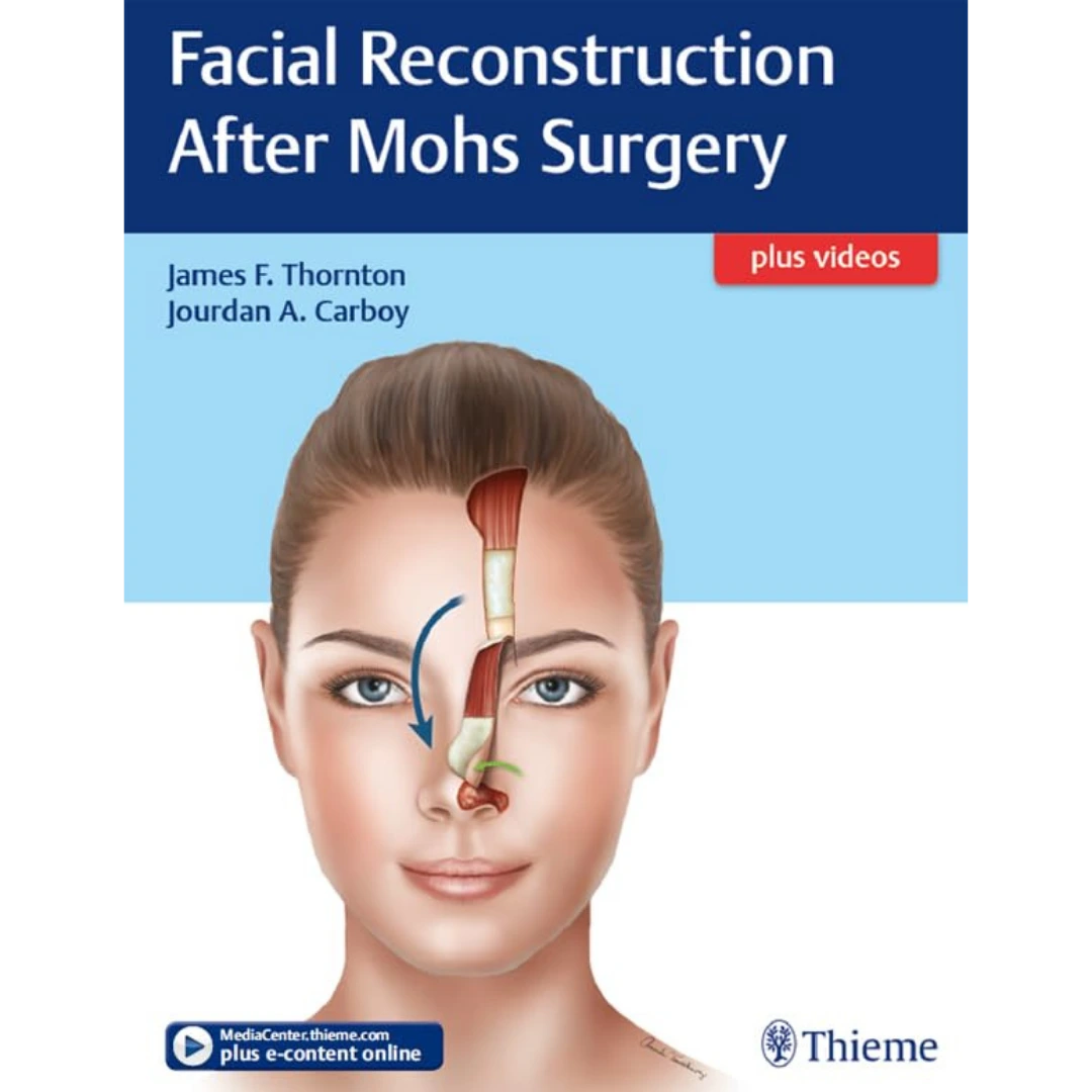 Facial Reconstruction After Mohs Surgery