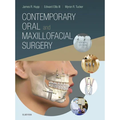 Contemporary Oral and Maxillofacial Surgery