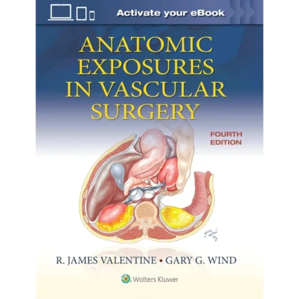 Anatomic Exposures in Vascular Surgery