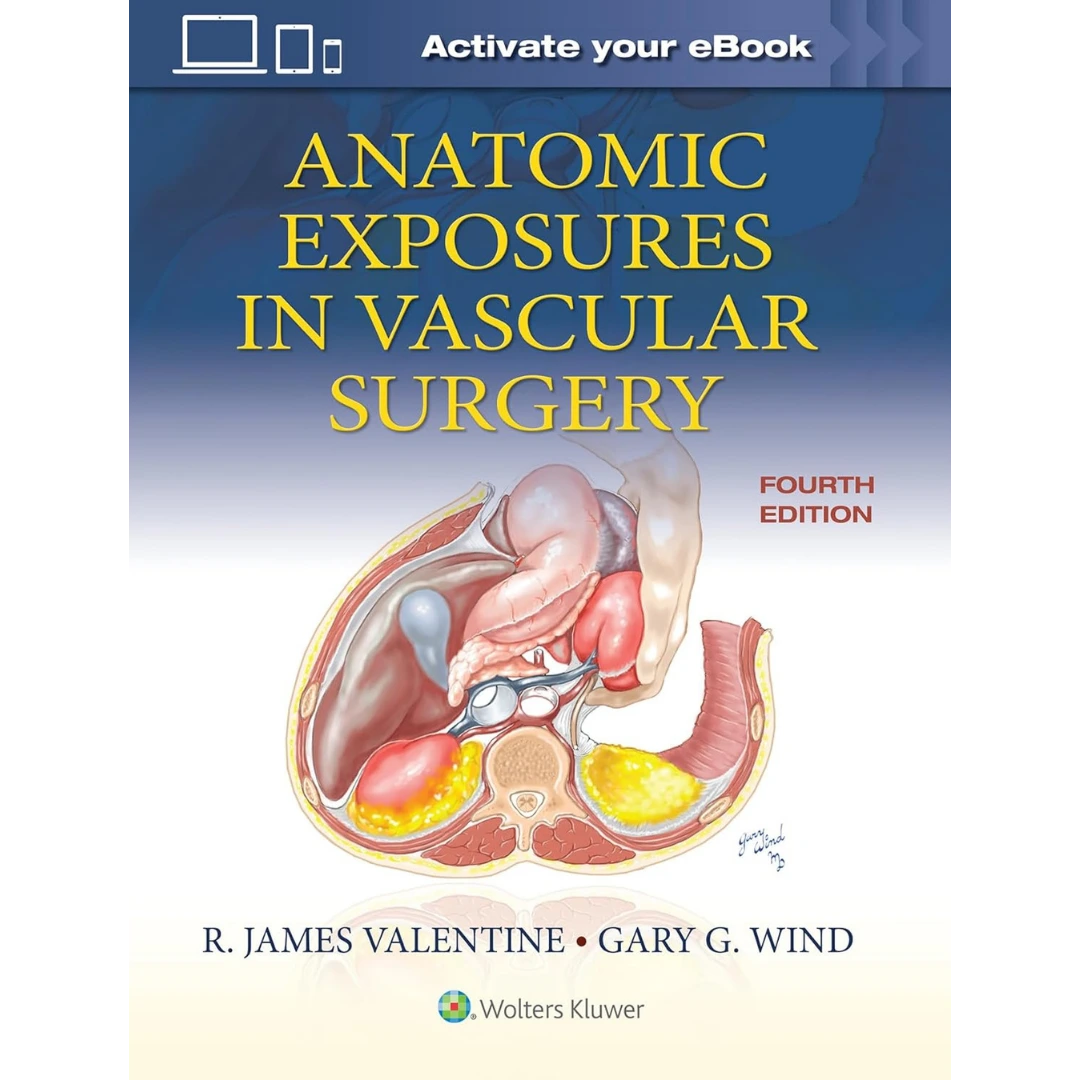 Anatomic Exposures in Vascular Surgery