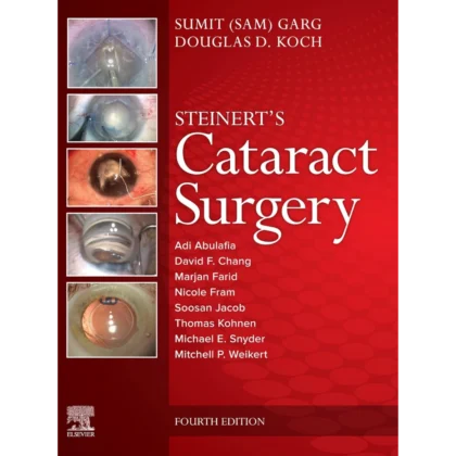 Steinert's Cataract Surgery
