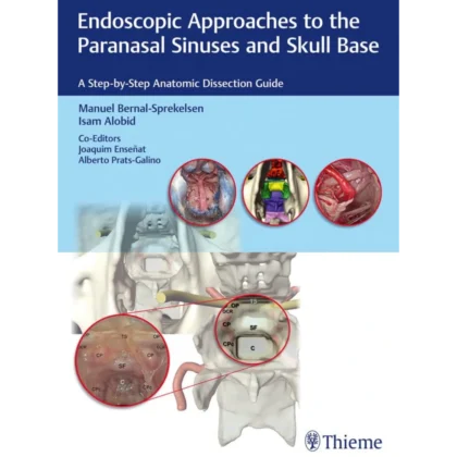 Endoscopic Approaches to the Paranasal Sinuses and Skull Base: A Step-by-Step Anatomic Dissection Guide