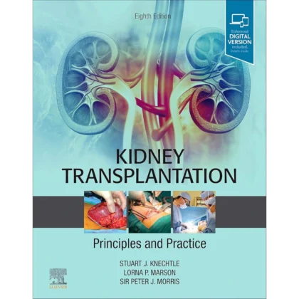 Kidney Transplantation - Principles and Practice