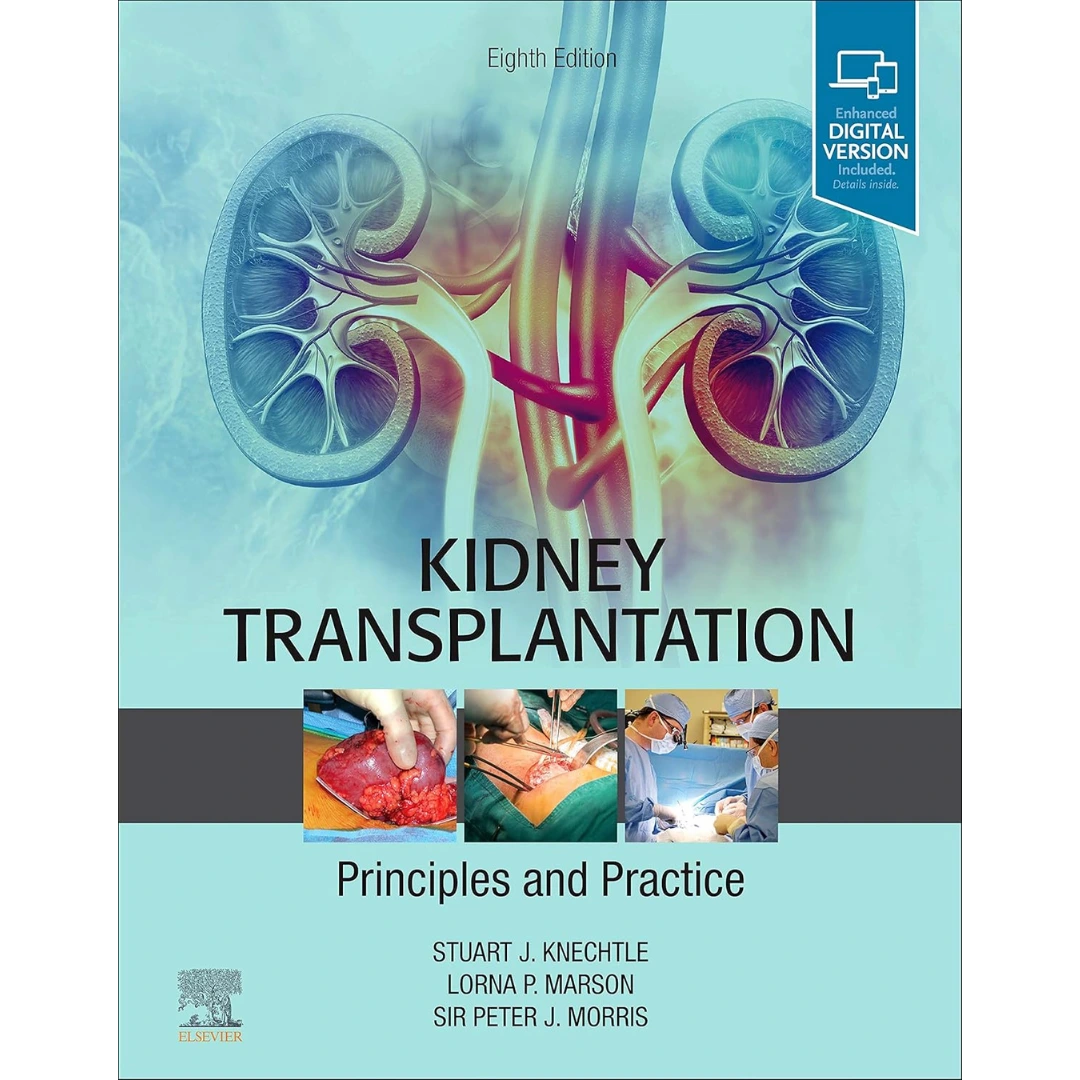 Kidney Transplantation - Principles and Practice