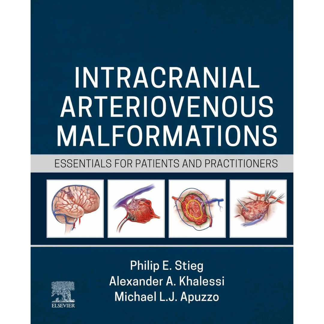 Intracranial Arteriovenous Malformations: Essentials for Patients and Practitioners