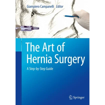 The Art of Hernia Surgery: A Step-by-Step Guide