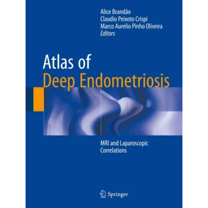 Atlas of Deep Endometriosis: MRI and Laparoscopic Correlations
