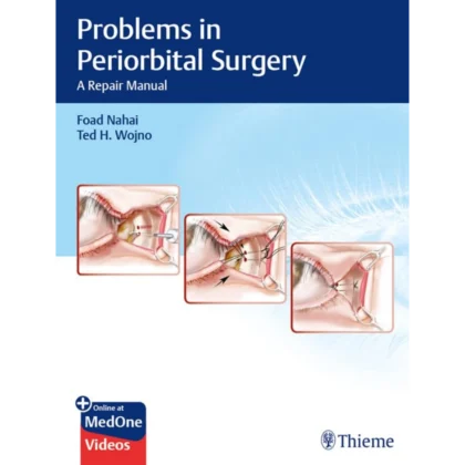 Problems in Periorbital Surgery: A Repair Manual