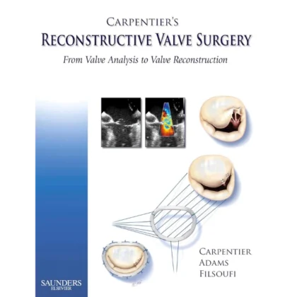 Carpentier's Reconstructive Valve Surgery