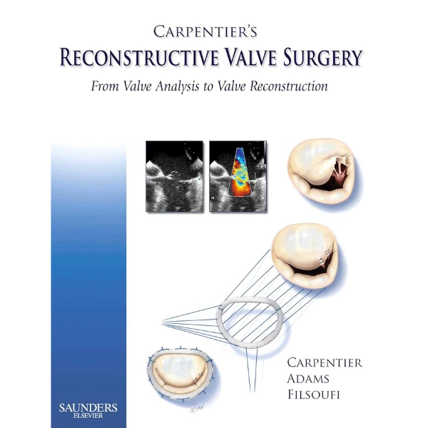 Carpentier's Reconstructive Valve Surgery