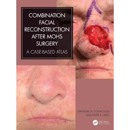 Combination Facial Reconstruction after Mohs Surgery: A Case Based Atlas