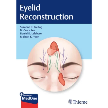 Eyelid Reconstruction