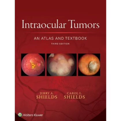 Intraocular Tumors: An Atlas and Textbook