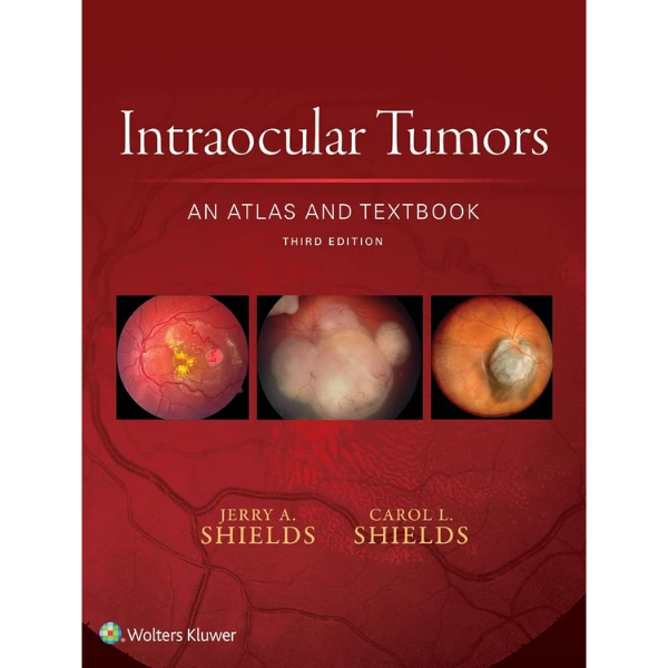 Intraocular Tumors: An Atlas and Textbook
