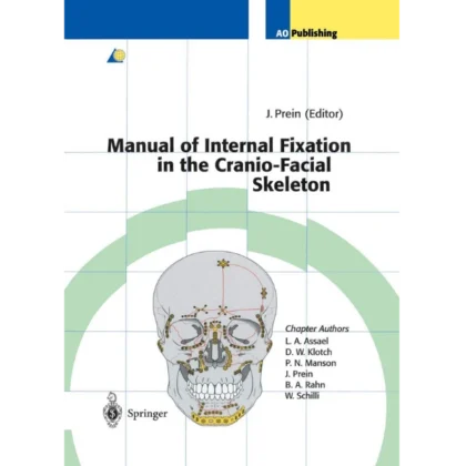 Manual of Internal Fixation in the Cranio-Facial Skeleton