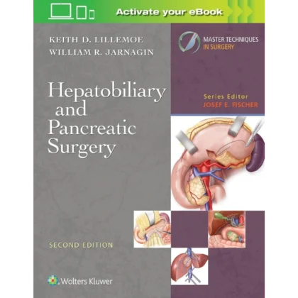 Master Techniques in Surgery: Hepatobiliary and Pancreatic Surgery