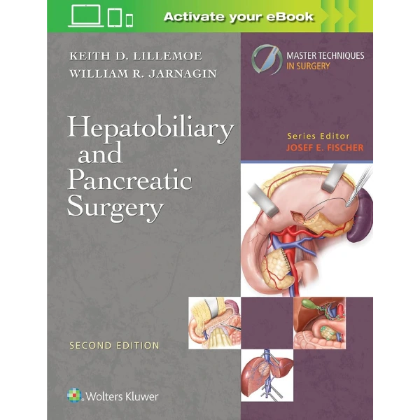 Master Techniques in Surgery: Hepatobiliary and Pancreatic Surgery