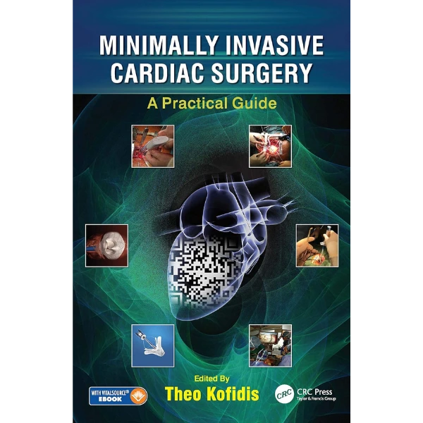 Minimally Invasive Cardiac Surgery: A Practical Guide