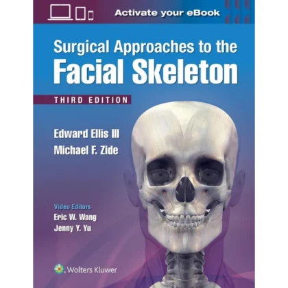 Surgical Approaches to the Facial Skeleton
