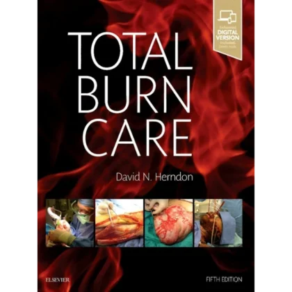 Total Burn Care