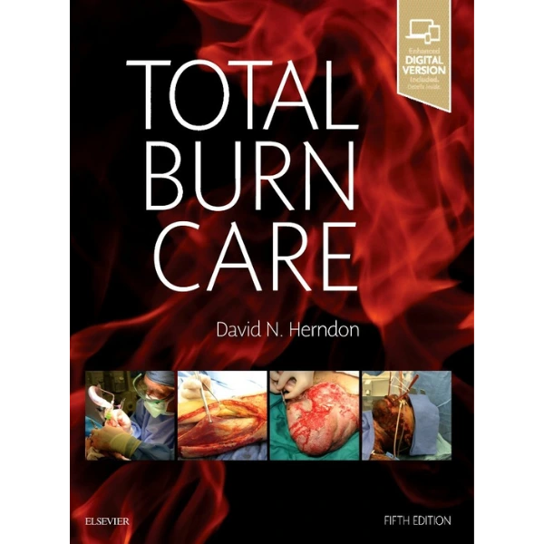Total Burn Care