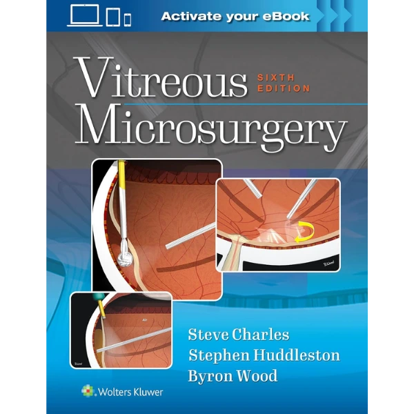 Vitreous Microsurgery