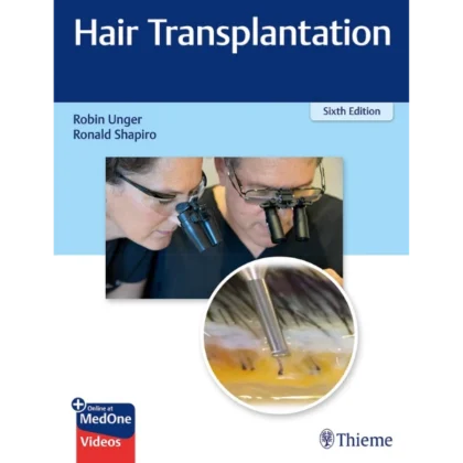 Hair Transplantation