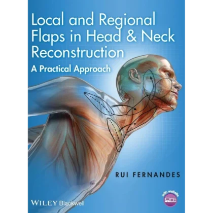 Local and Regional Flaps in Head and Neck Reconstruction: A Practical Approach